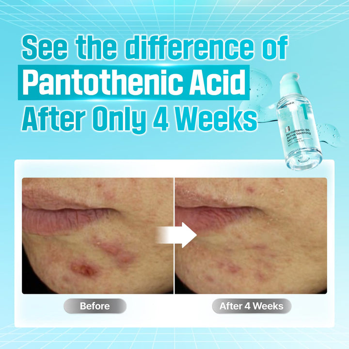 numbuzin No.1 Pantothenic B5 Active Soothing Serum 50ml, 1.69 fl. oz.