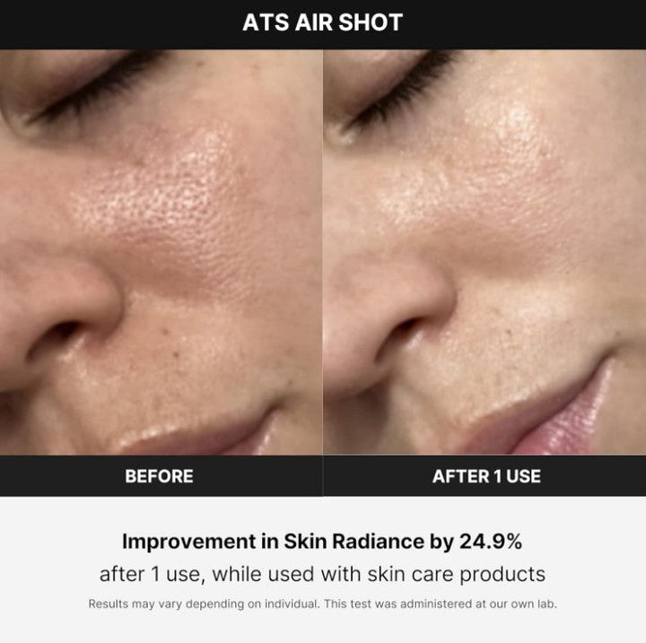 Medicube Age-R ATS Air Shot