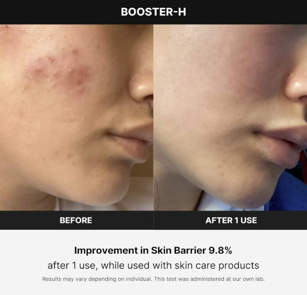 Medicube Age-R Booster H