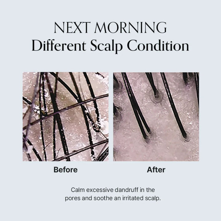 Damage Therapy Scalp Scaling Ampoule 50ml / 1.69 fl. oz.