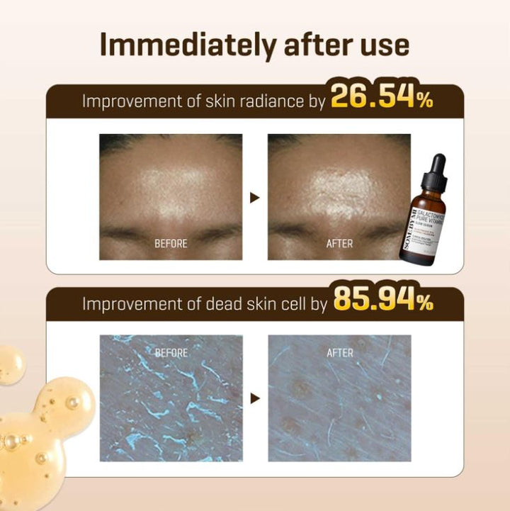 Galactomyces Pure Vitamin C Glow Serum 30ml / 1.01 oz.