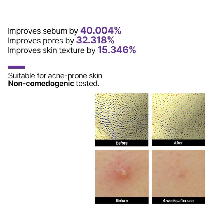 SOME BY MI Retinol Intense Reactivating Serum 30ml/50ml