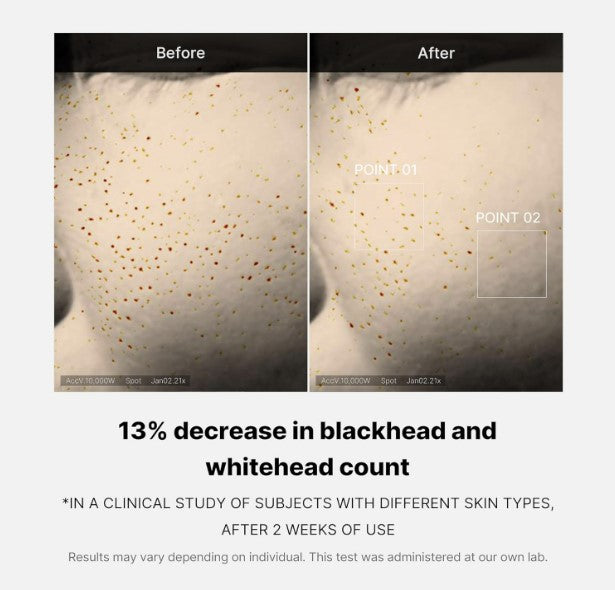 Medicube Zero Pore One-day Serum 30ml